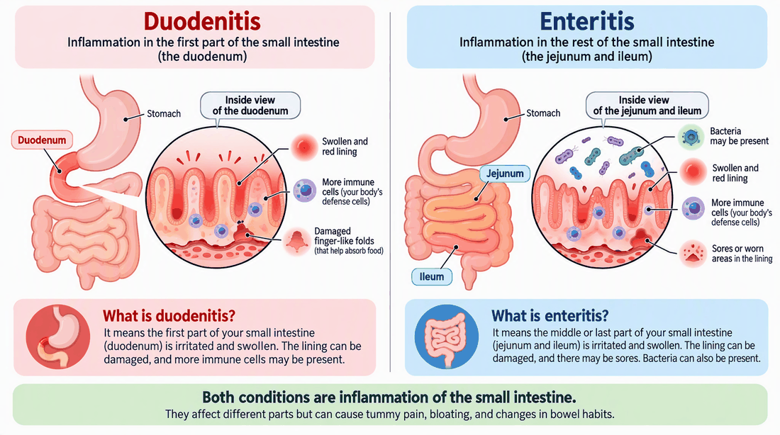Duodenitis and enteritis: inflammation of different parts of the small intestine